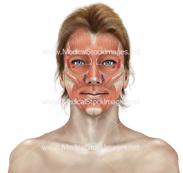 Botox Injections Points – Medical Stock Images Company