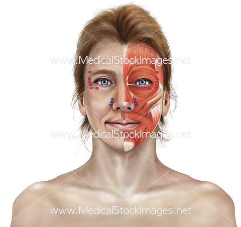 Botox Injection Points of Facial Muscle Anatomy and Skin