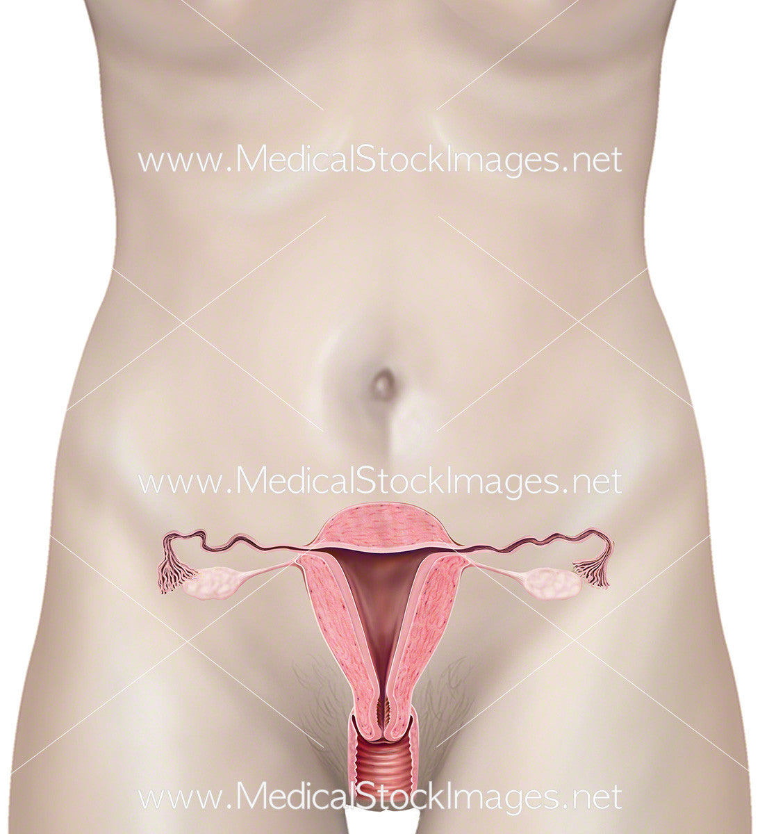 Uterus with Female Body – Medical Stock Images Company