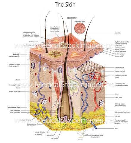 Skin Eczema