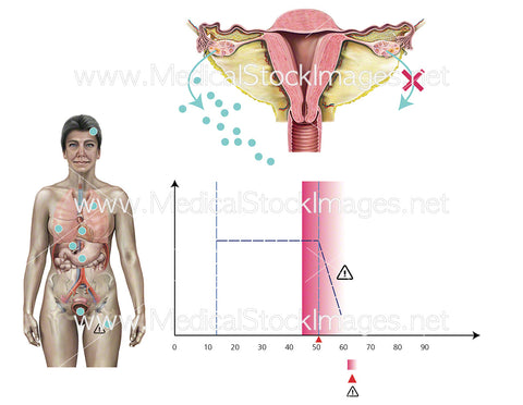 Onset of the Menopause