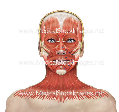 Botulinum Toxin Injection Points
