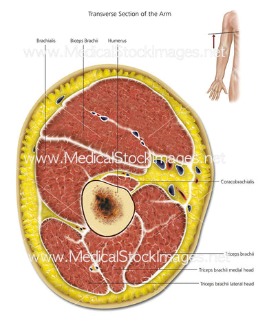 Transverse Section of the Arm - Labelled