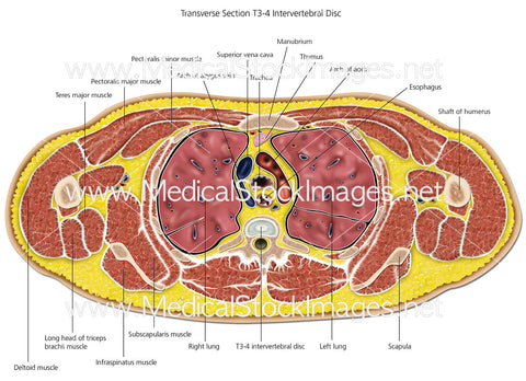 Transverse Section of T3-4 Intervertebral Disc - Labelled