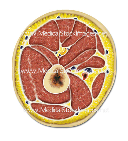 Transverse Section of the Thigh