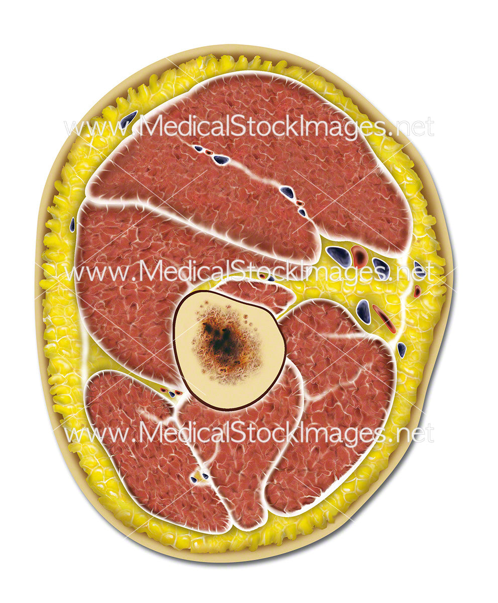 Transverse Example Anatomy Transverse Section Anatomy