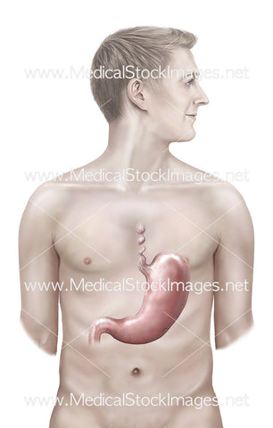 Male Figure Showing Esophagus Spasm and Stomach