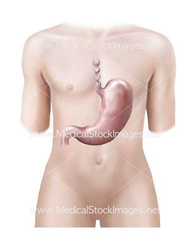 Androgynous Figure Showing Esophagus Spasm and Stomach