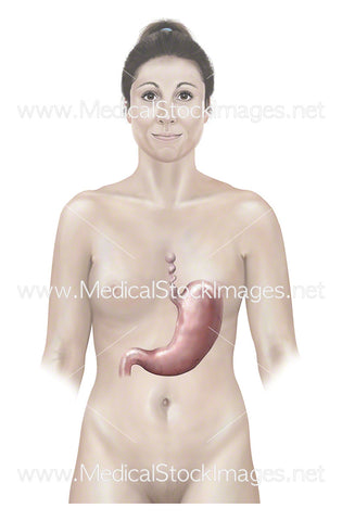 Female Figure Showing Esophagus Spasm and Stomach