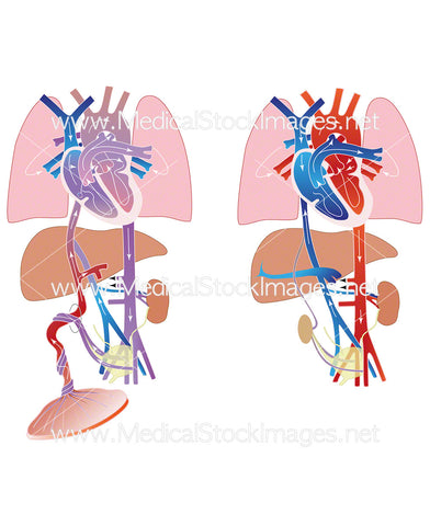 Fetal and Neonatal Circulatory System