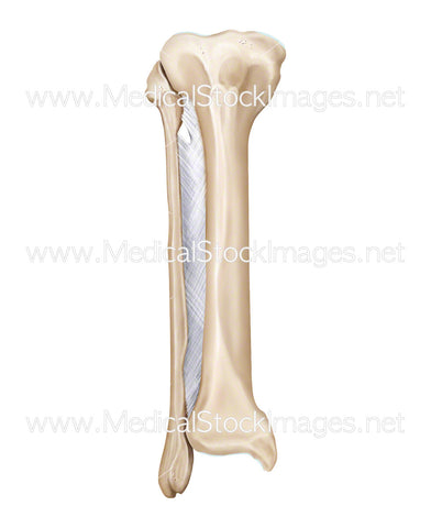 Tibia and Fibula Bones with Interosseous Membrane