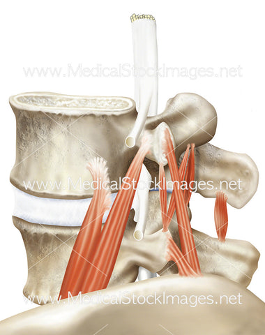 Interspinal Muscle Normal Anatomy