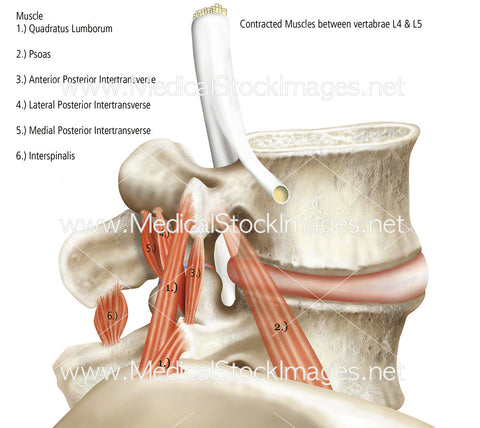 Vertebrae Under Compression With Muscles - Labelled