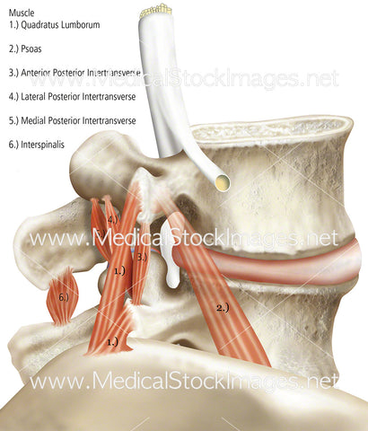 Vertebrae under Compression Showing Muscles as Red Layers