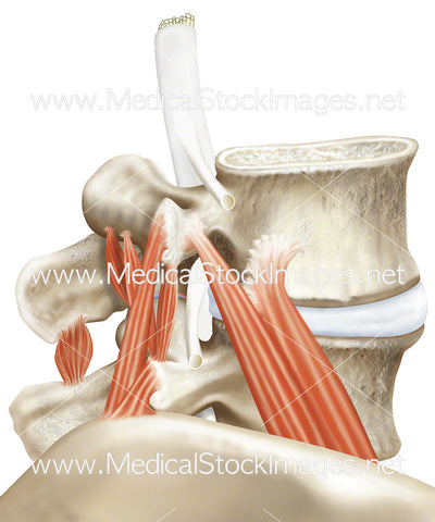 Vertebrae under Compression with Contracted Muscles