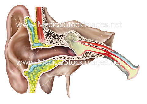 Otitis Media or Middle Ear Infection