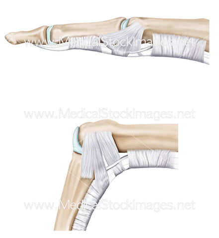 Ligaments of the Finger when Stretched and Relaxed