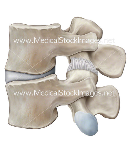 Medial View of Lumbar Vertebrae