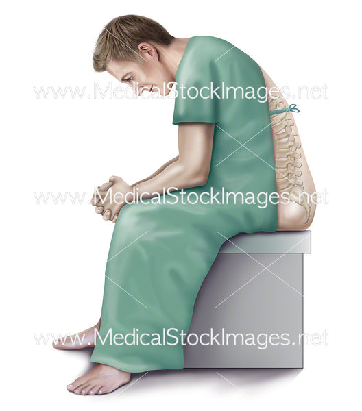 Patient Positioning for Lumbar Surgery – Medical Stock Images Company