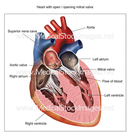 Heart with Open Mitral Valve