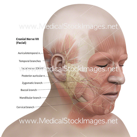 Facial Nerves Associated with Bells Palsy Showing Facial Muscles - Labelled