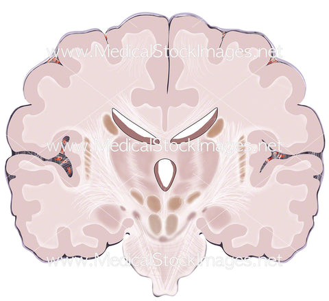 Coronal View through the Brain
