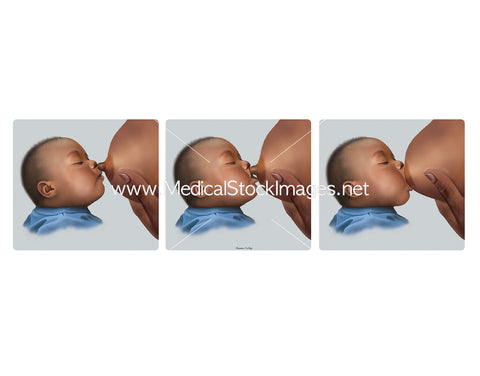 Breastfeeding: Correct latching attachment, infant - Black African American