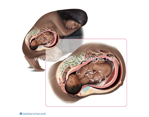 Black Woman in Preparation During the Second Stages of Giving Birth