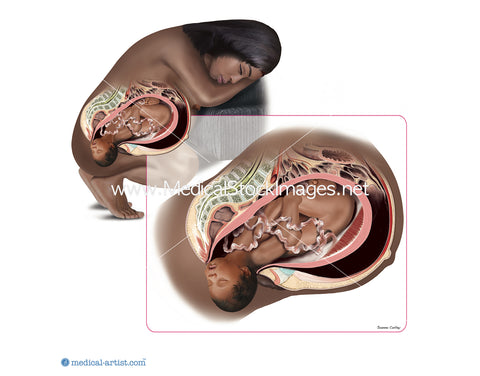 Black Woman in Preparation During the Third Stages of Giving Birth