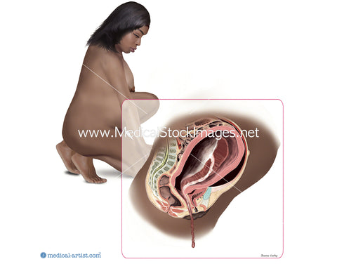 Black Woman with Birth Completed