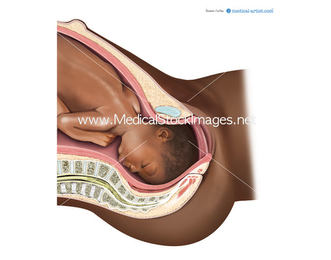Cephalic Presentation - Baby Positioned Ready for Birth (African heritage)