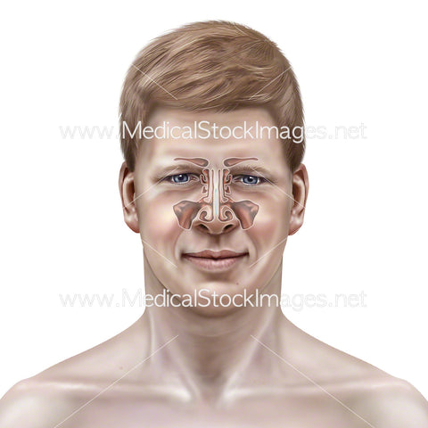 Coronal Sinuses