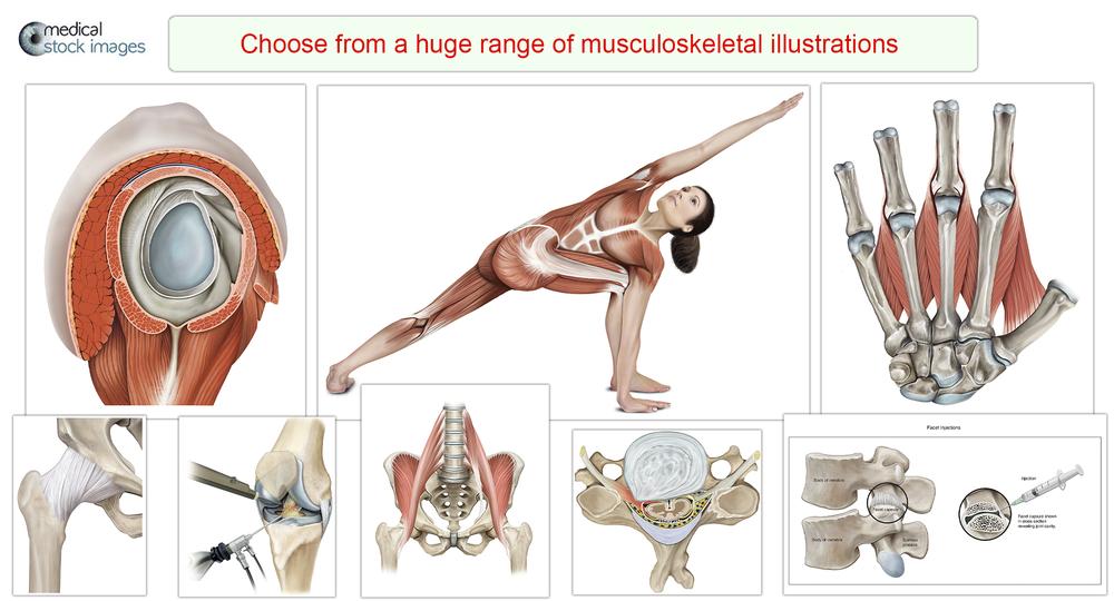 Choose from a huge range of musculoskelatal illustrations